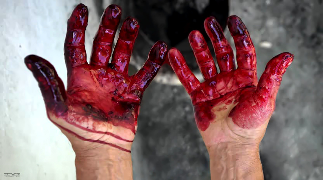 The Self-Inflicted Defense Method - Bloody Hands | DETCADER